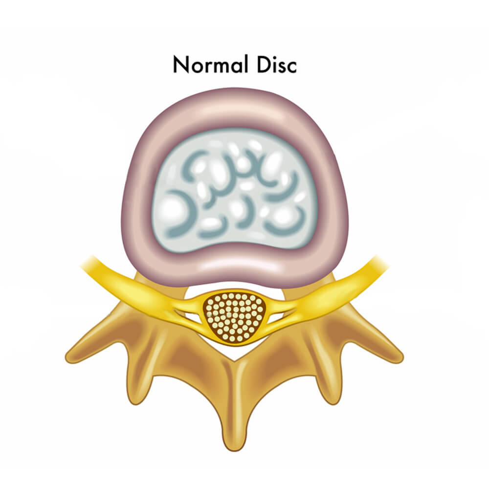 Disc In Human Body The Science Behind Spinal Disc Rehydration - RennWellness
