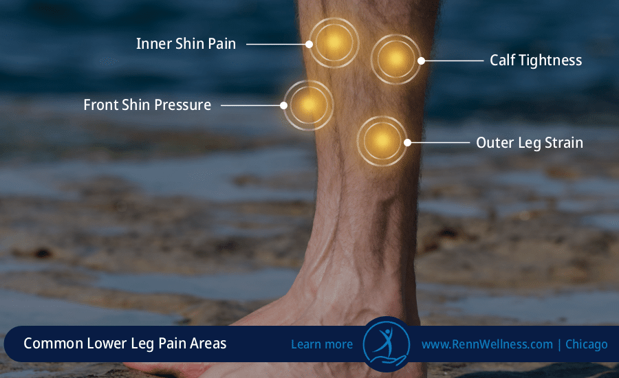 lower leg pain areas highlighted with amber glow including shin calf and outer leg