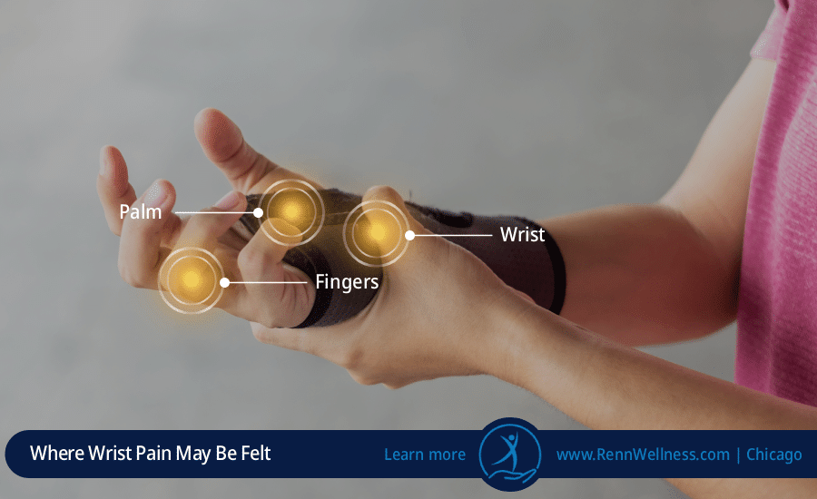 common wrist pain locations forearm hand diagram chicago chiropractor